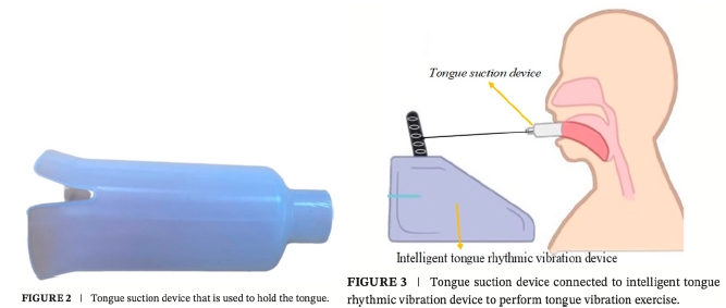 舌頭拉伸杯與智能舌頭震動訓練系統示意圖